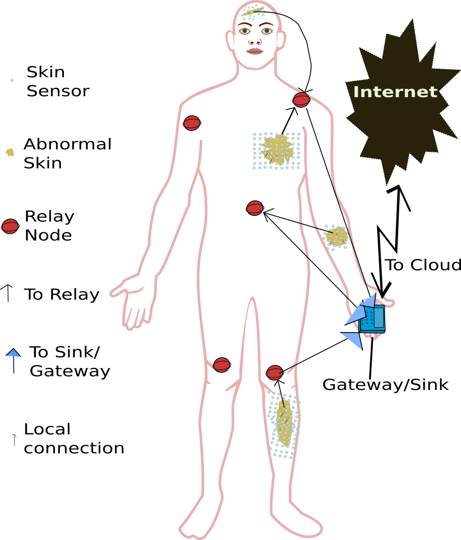 Refer to caption