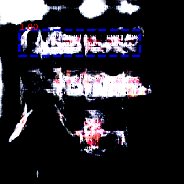 Refer to caption