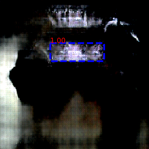 Refer to caption