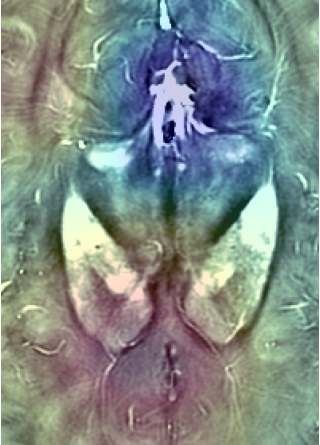 Refer to caption