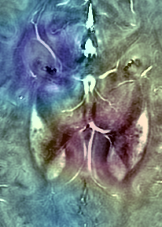 Refer to caption