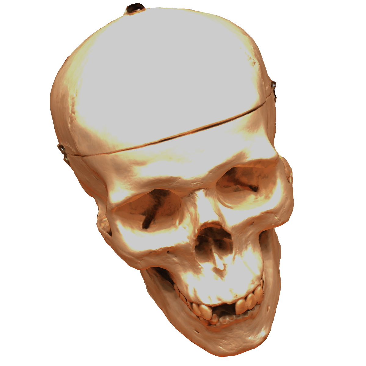 Refer to caption