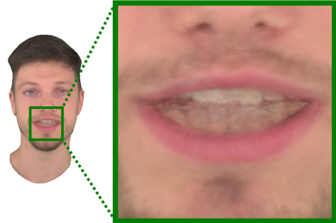 Refer to caption