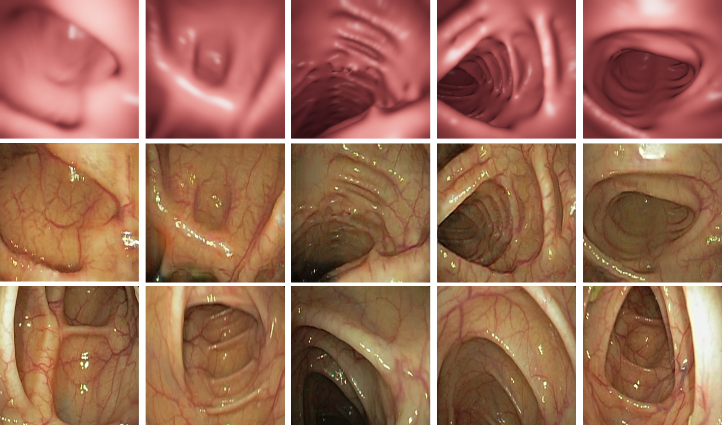 Refer to caption
