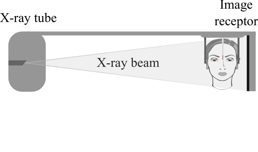 [2202.06366] Learning Perspective Deformation in X-Ray Transmission Imaging