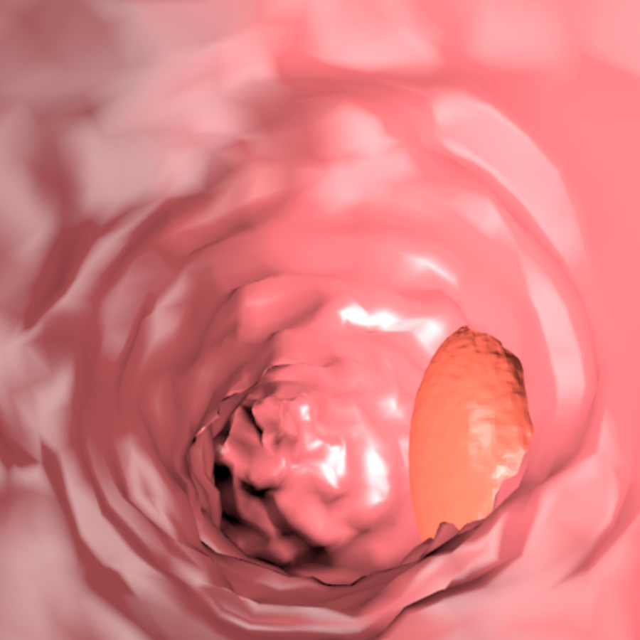 Refer to caption