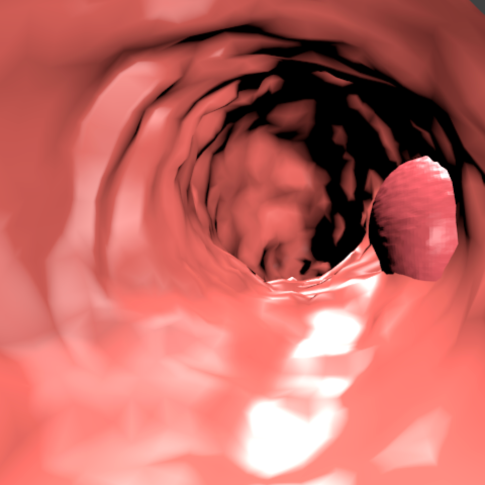 Refer to caption