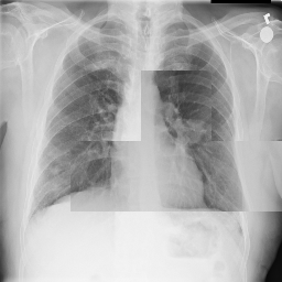 Refer to caption