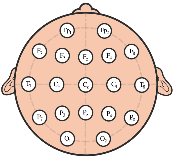 Refer to caption
