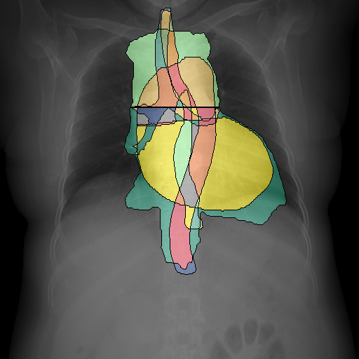 Refer to caption