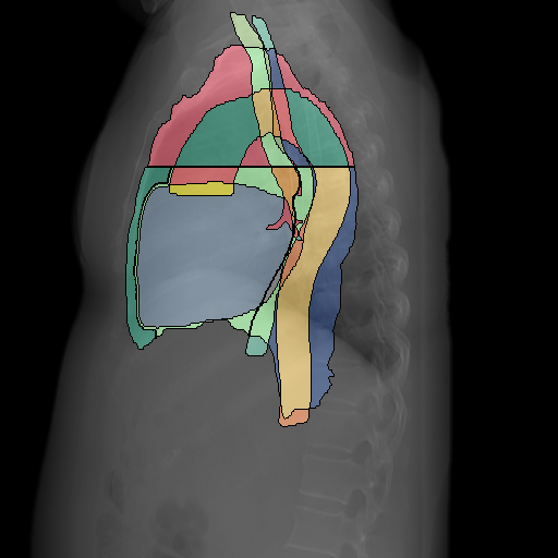 Refer to caption