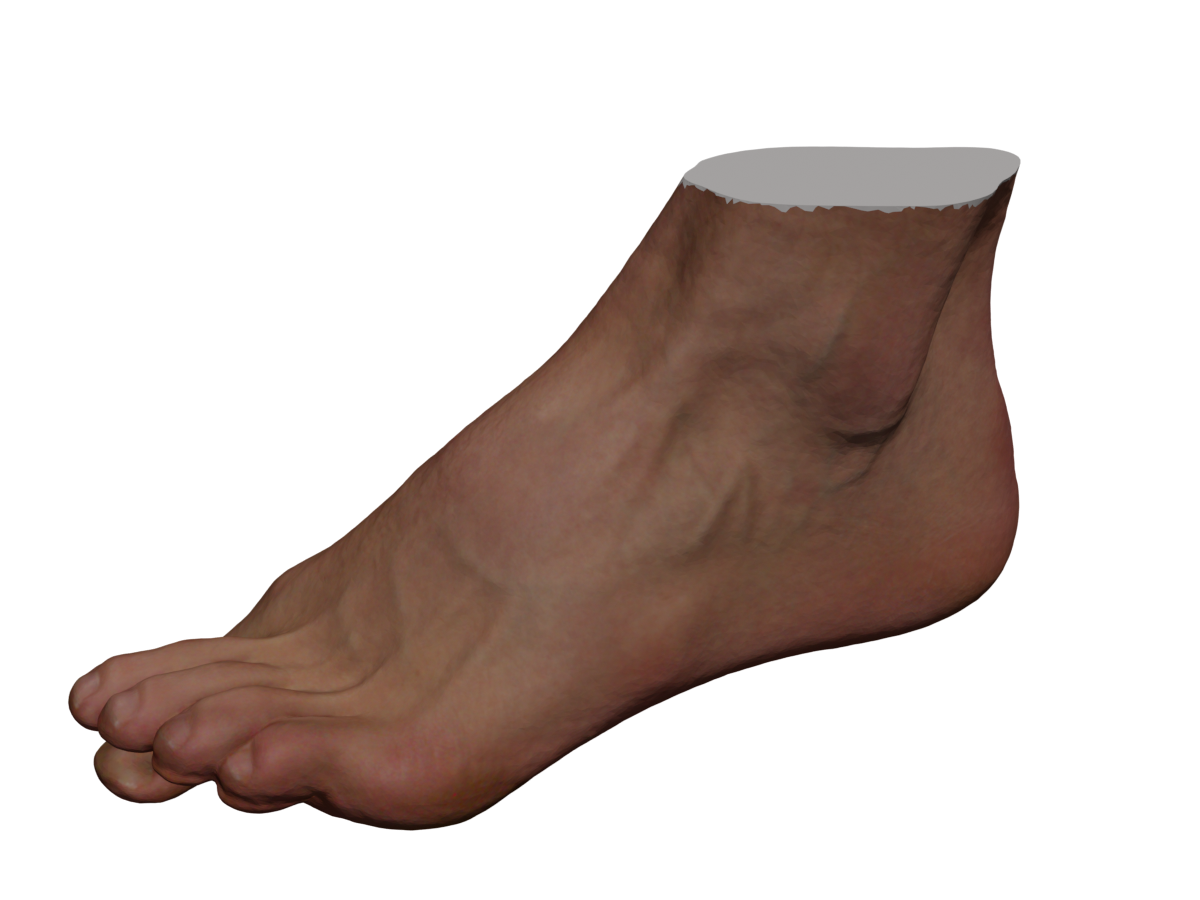 Refer to caption