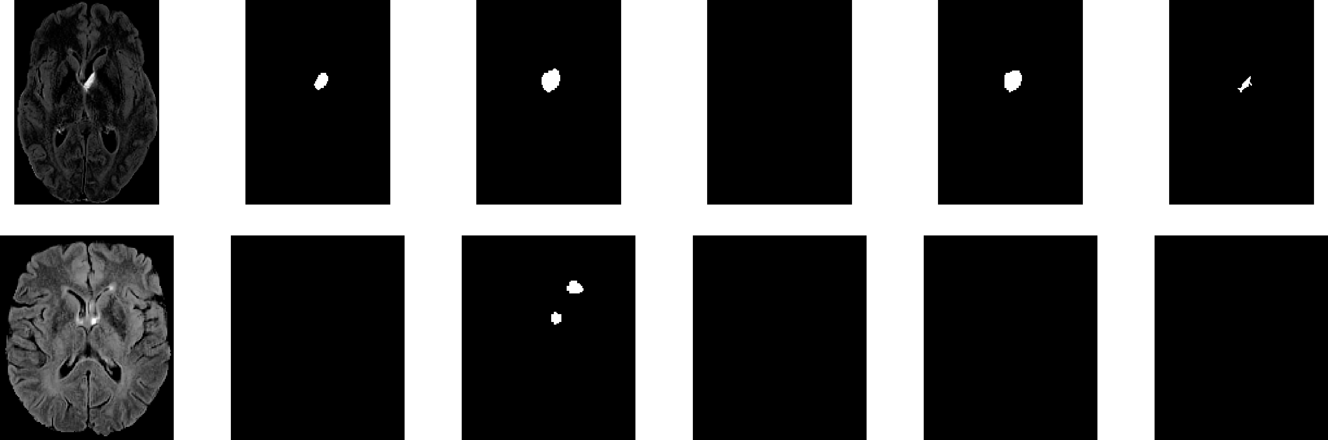 Refer to caption