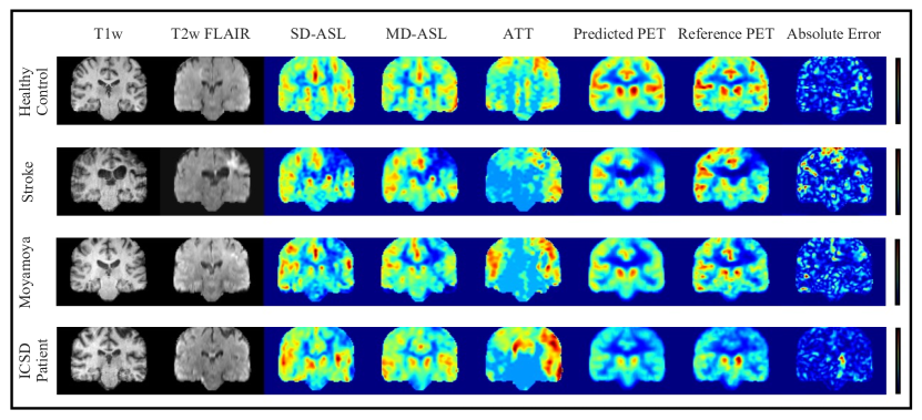 [2211.12082] Brain MRI-to-PET Synthesis using 3D Convolutional ...
