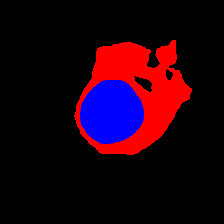 Refer to caption