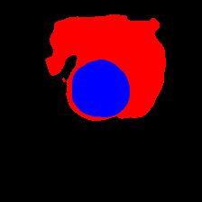 Refer to caption