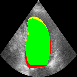 Refer to caption