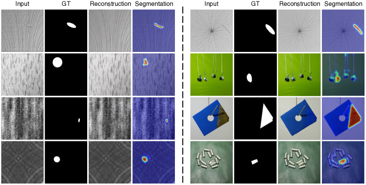 [2303.08730] DiffusionAD: Norm-guided One-step Denoising Diffusion for ...