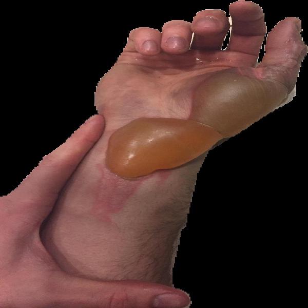 Refer to caption