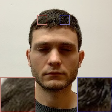 Refer to caption