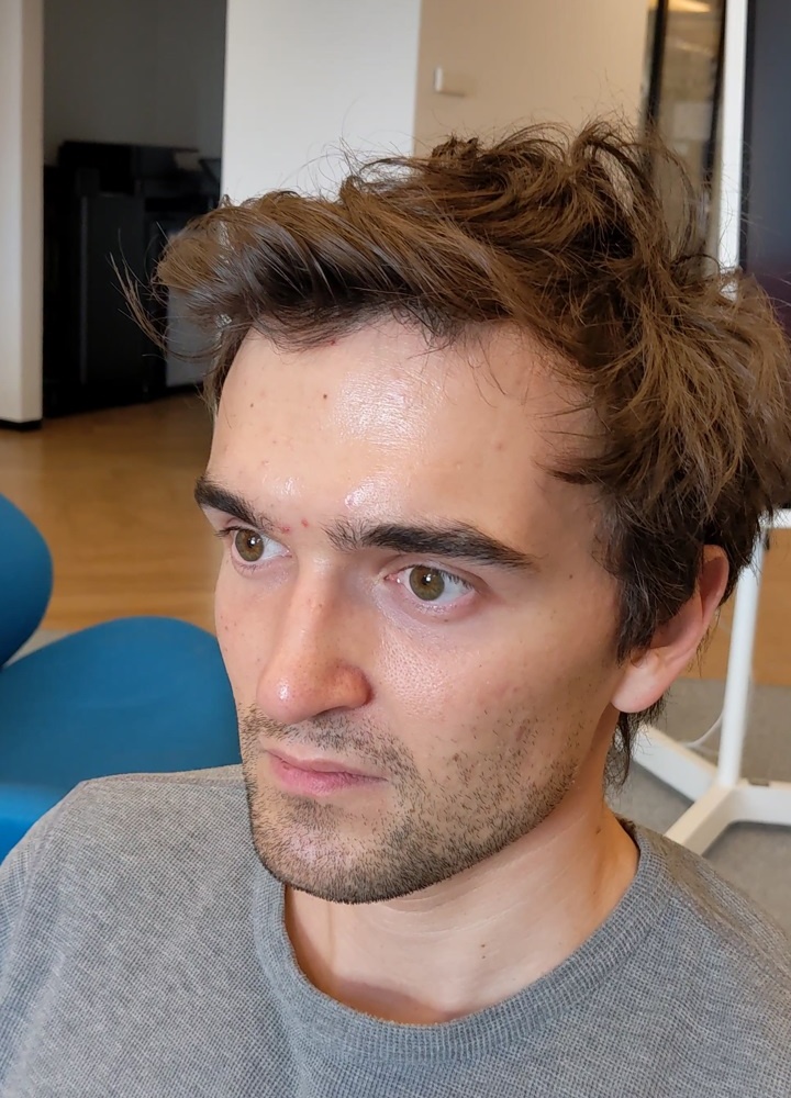 Refer to caption