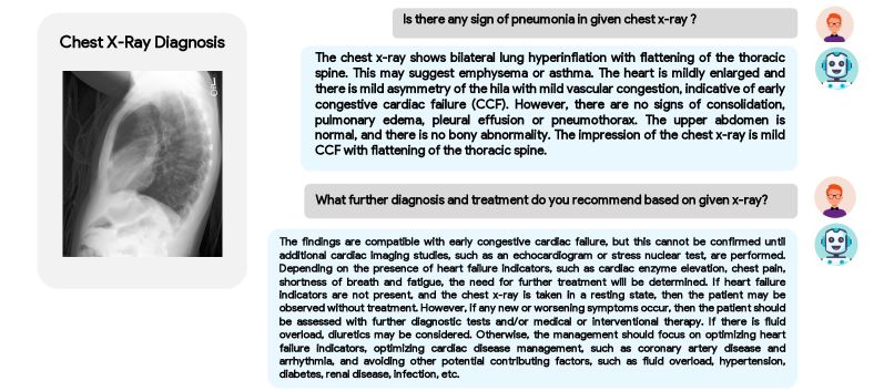 [2306.07971] XrayGPT: Chest Radiographs Summarization Using Large ...