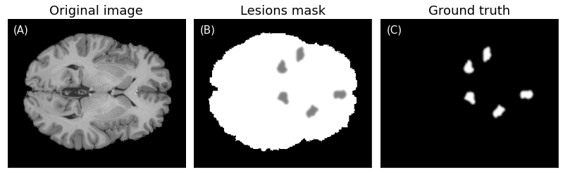 Refer to caption