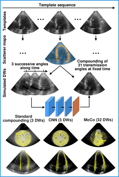 [2306.14265] Ultrafast Cardiac Imaging Using Deep Learning For Speckle ...