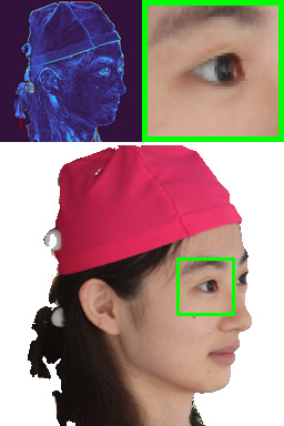 Refer to caption