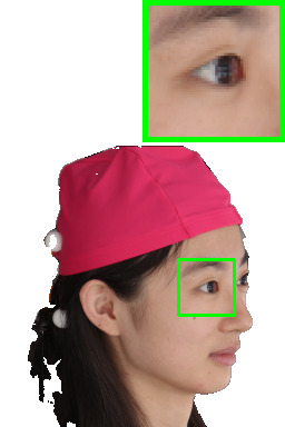 Refer to caption