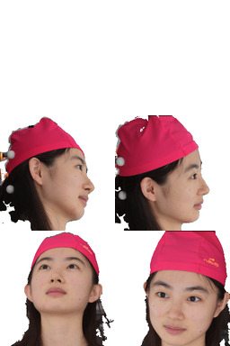 Refer to caption