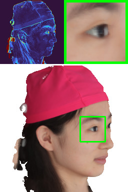 Refer to caption