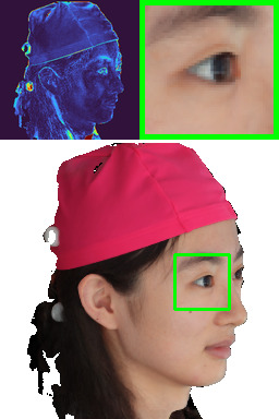 Refer to caption