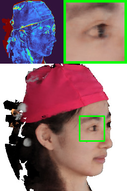 Refer to caption