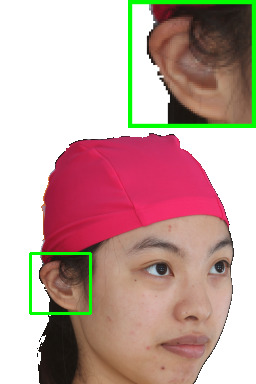 Refer to caption