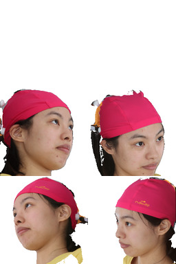 Refer to caption