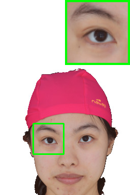 Refer to caption