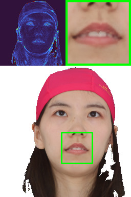 Refer to caption
