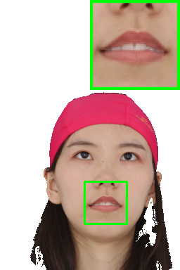 Refer to caption