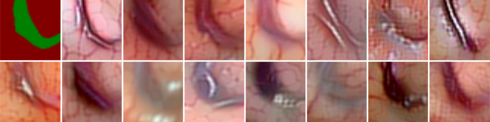 Refer to caption