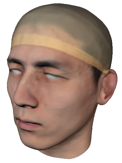 Refer to caption