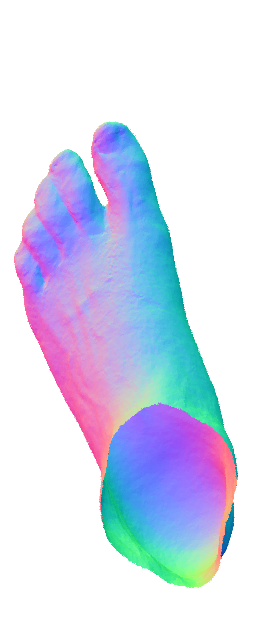Refer to caption