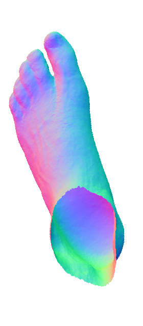 Refer to caption