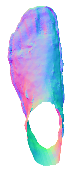 Refer to caption