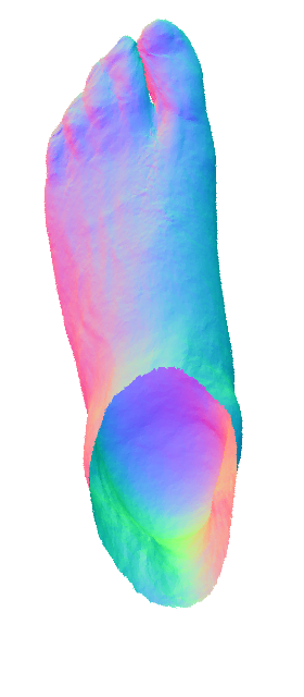 Refer to caption