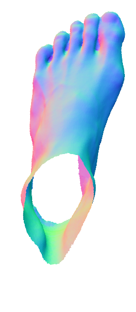 Refer to caption