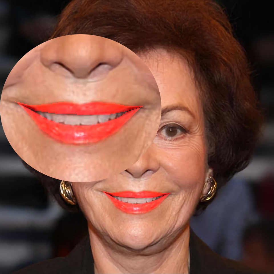 Refer to caption