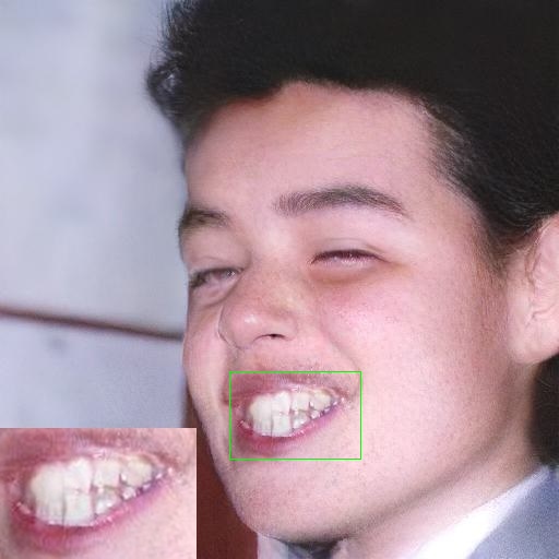 Refer to caption