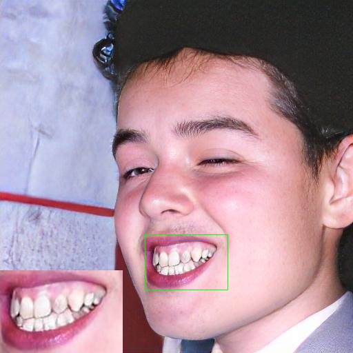 Refer to caption