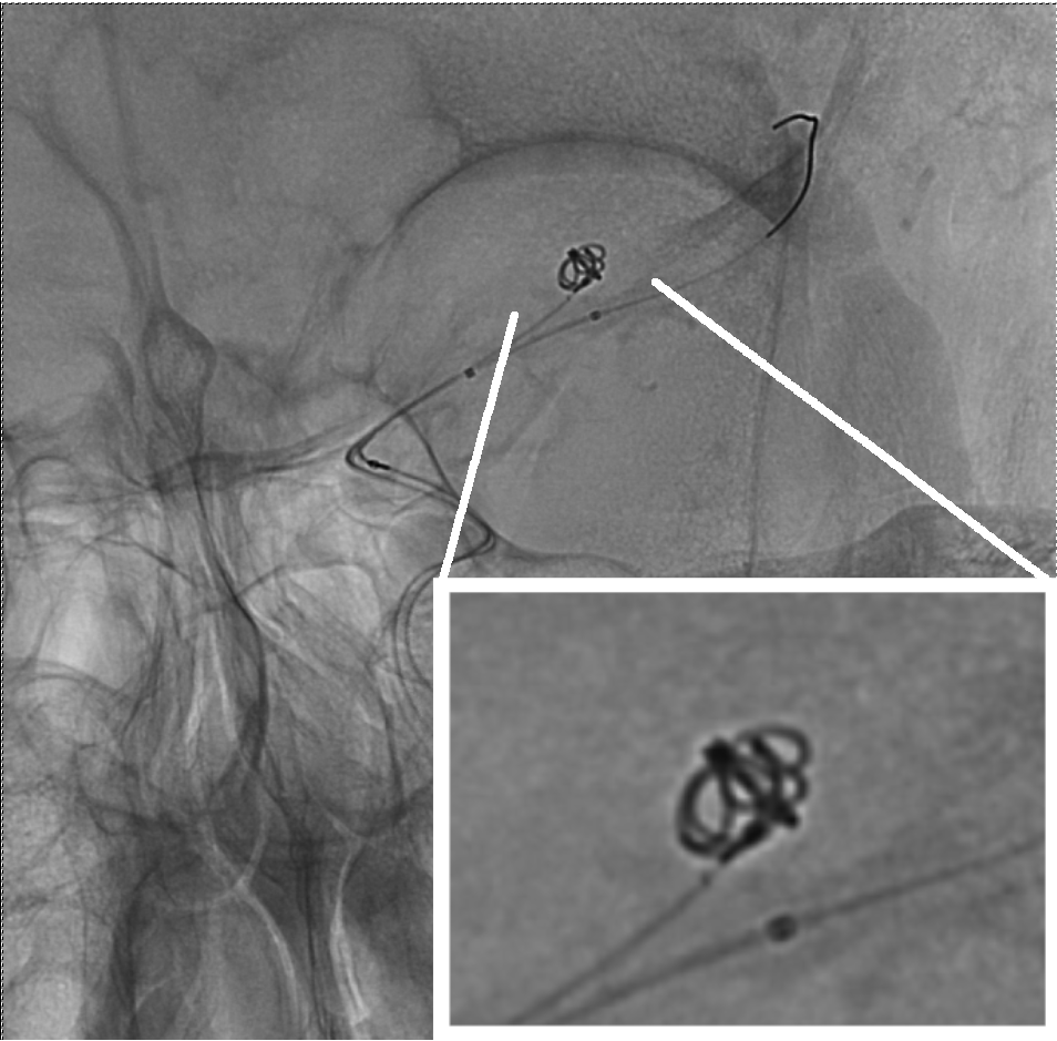 [2402.02798] A Comprehensive Numerical Approach to Coil Placement in